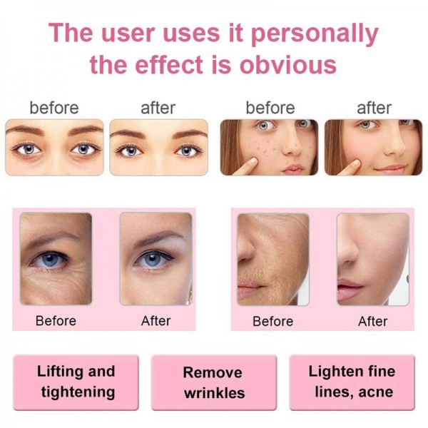 Dispositivo De Limpeza De Rejuvenescimento